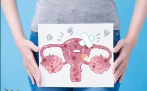 سرطان دهانه رحم