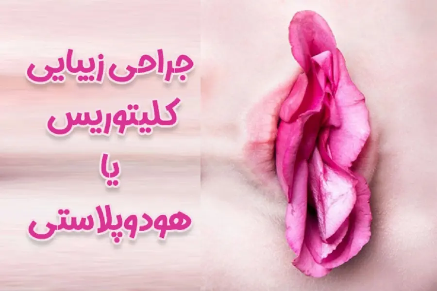 جراحی زیبایی کلیتوریس در بوشهر