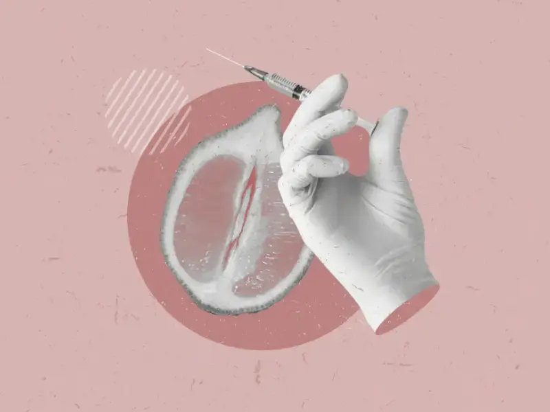 پیآرپی واژن